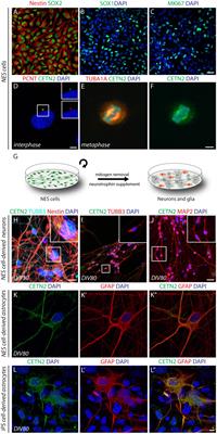 Centrin 2: A Novel Marker of Mature and Neoplastic Human Astrocytes